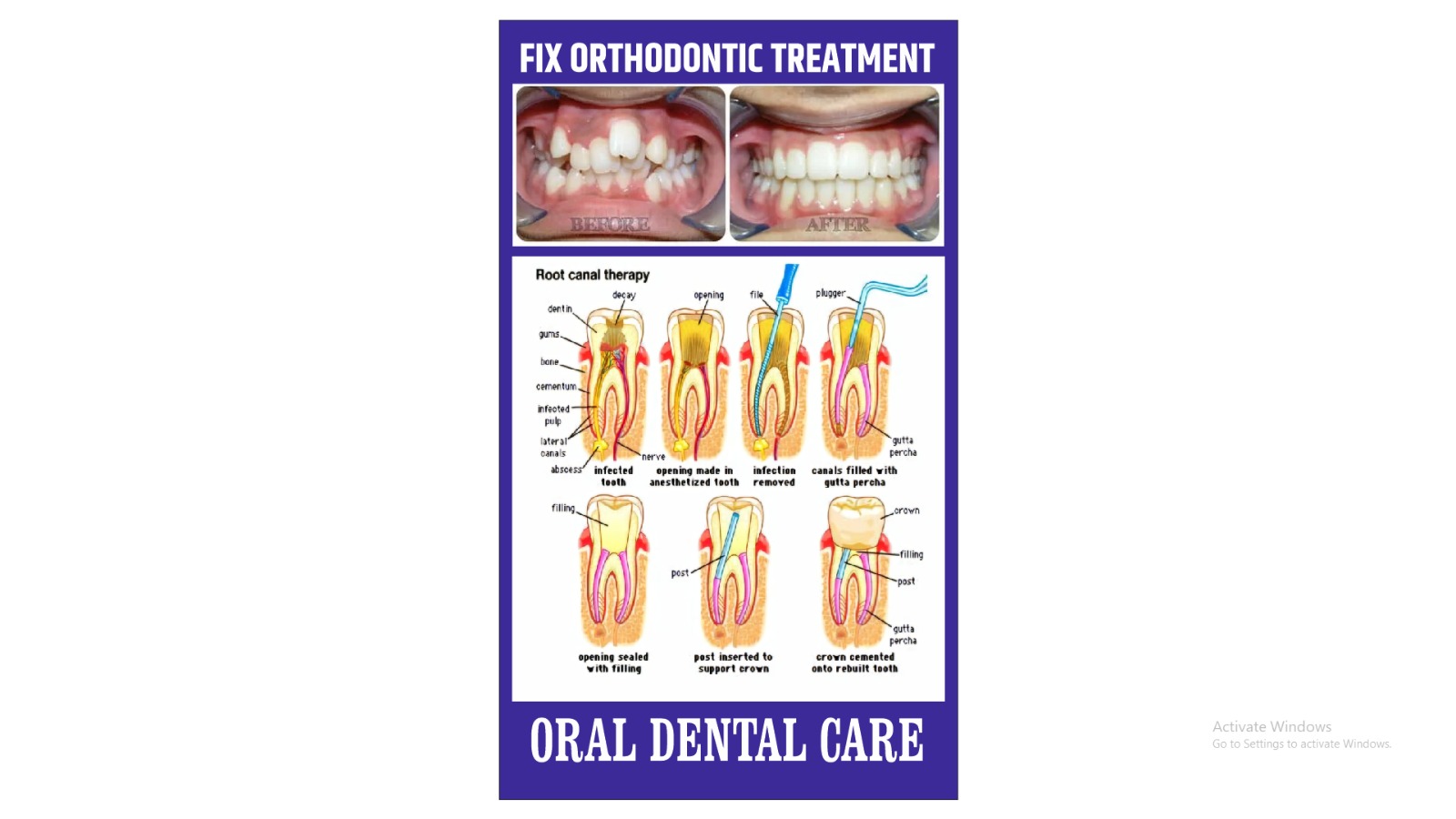 Orthodontic Treatment