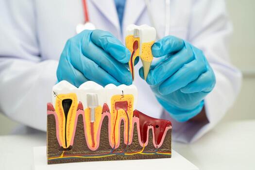 Root Canal Treatment